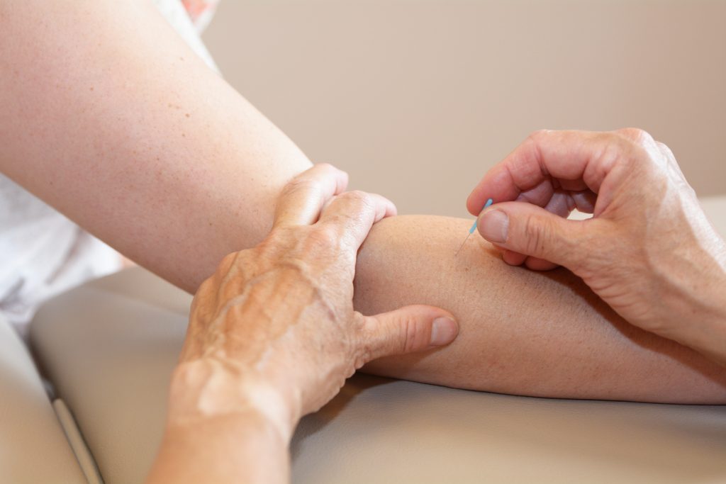 Dry needling fysiotherapie oosterpoort enschede